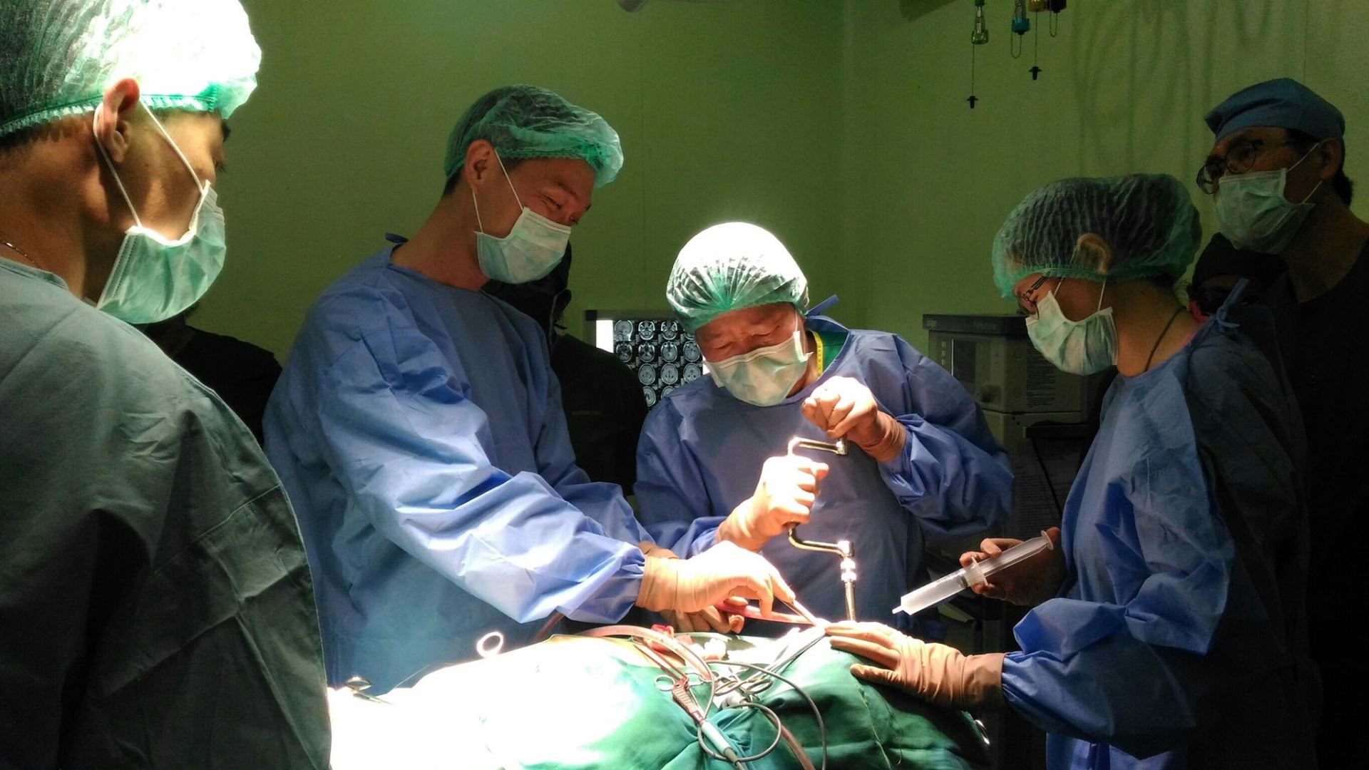 2018年關皚麗醫師(左3)帶醫療團在印尼為腦瘤病人進行腦室腹腔引流術。