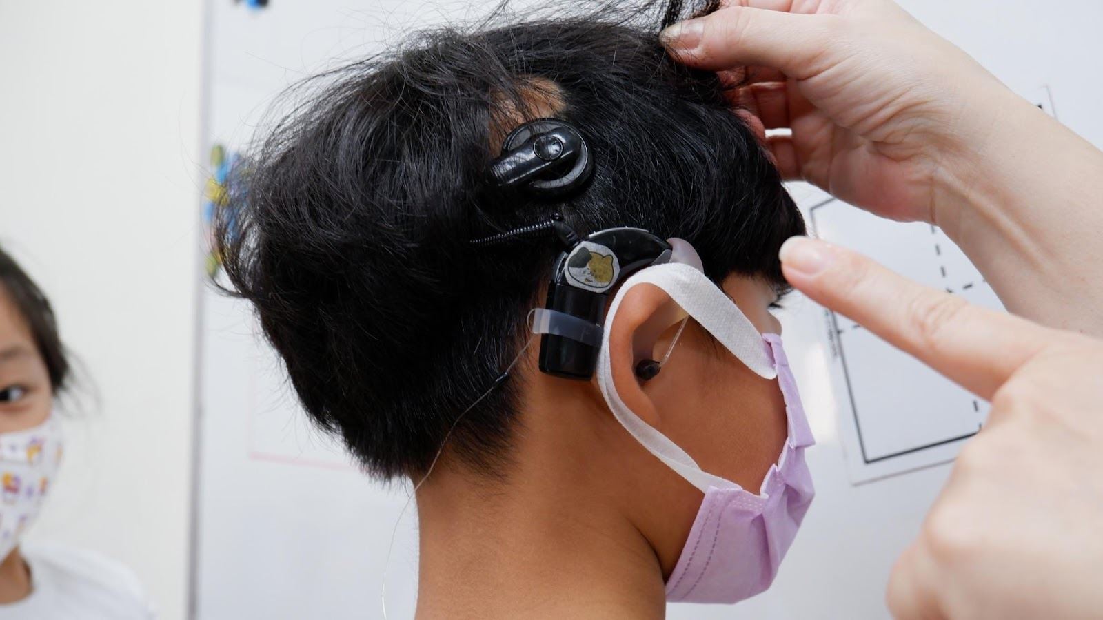 人工電子耳。攝影／張芷馨