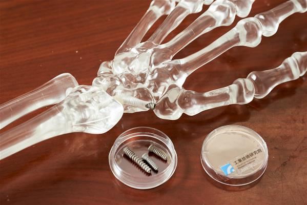 3D列印技術製造的「仿生中空骨釘」,因與人體組織的密合度高、生物相容性佳,經實驗證實,可大幅縮短患者復原時間。